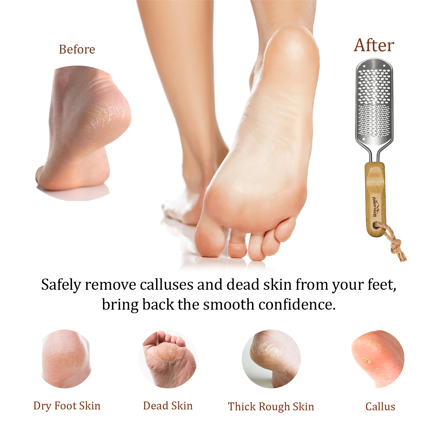 Pumice Valley  Foot Rasp Callus Remover - Pedicure Scrubber for